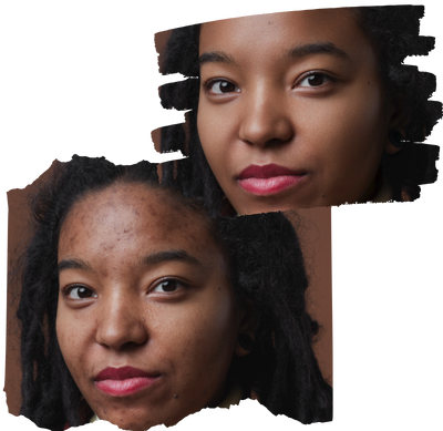 Before and after comparison of portrait skin editing with evoto ai